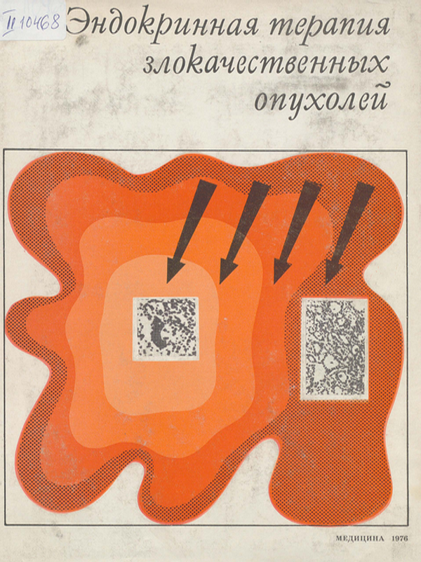 Эндокринная терапия злокачественных опухолей