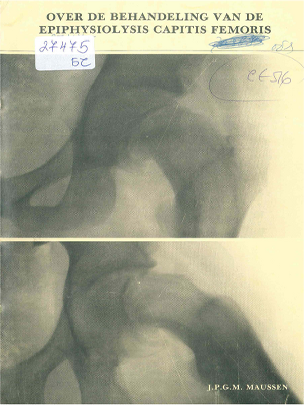 Over de behandeling van de epiphysiolysis capitis femoris
