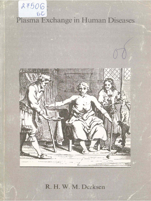 Plasma exchange human diseases