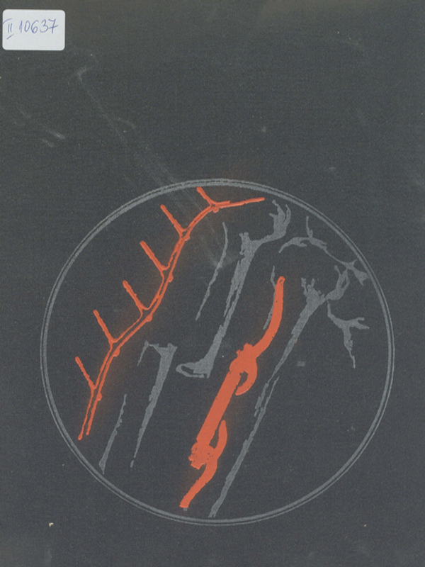Metallic osteosyntesis of bone fractures based on the topography of bone resistance
