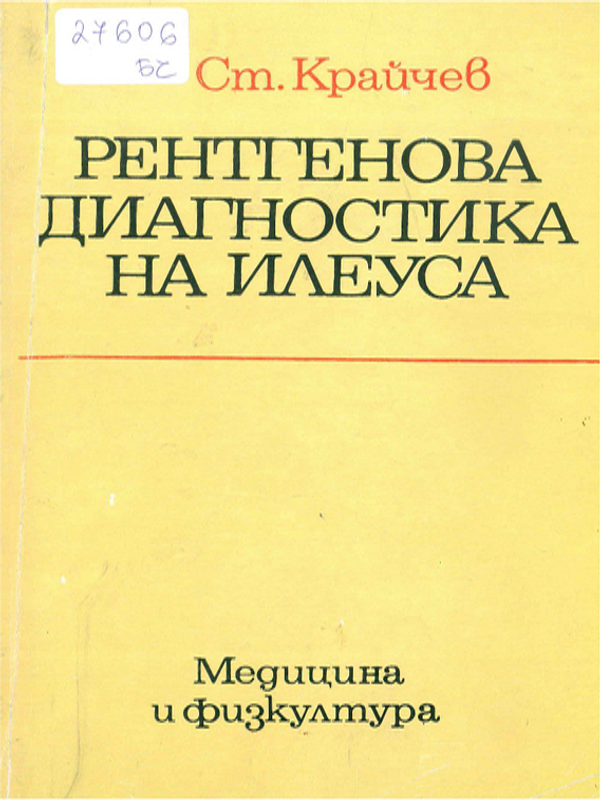 Рентгенова диагностика на илеуса