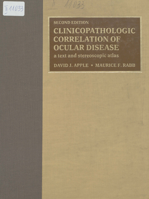 Clinicopathologic correlation of ocular disease