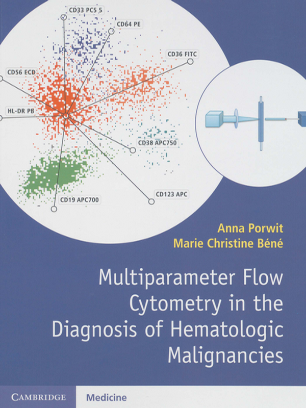 Multiparameter Flow Cytometry in the Diagnosis of Hematologic Malignancies