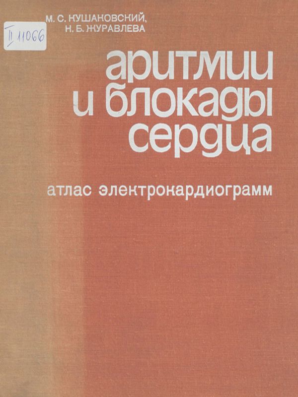 Аритмии и блокады сердца