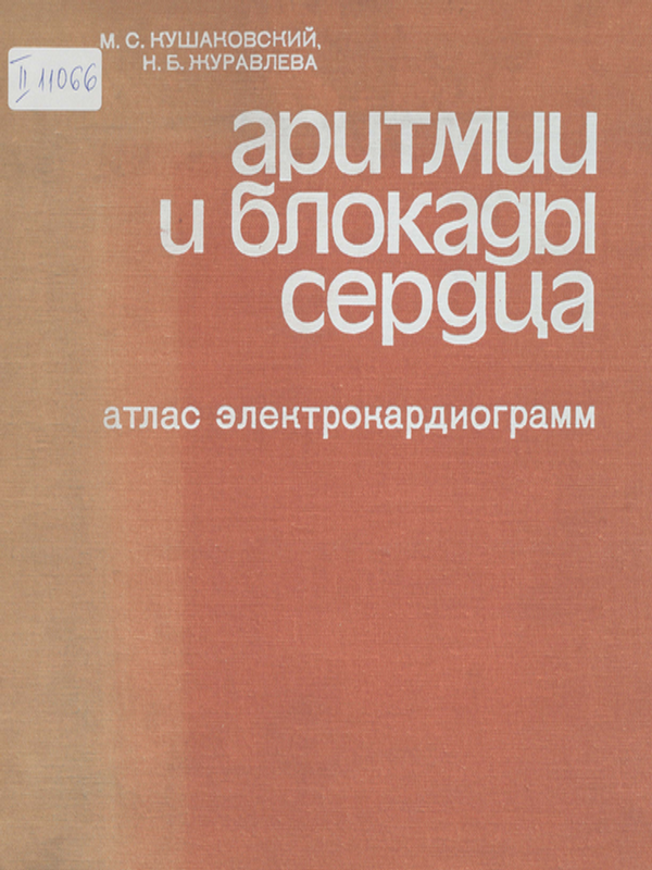 Аритмии и блокады сердца