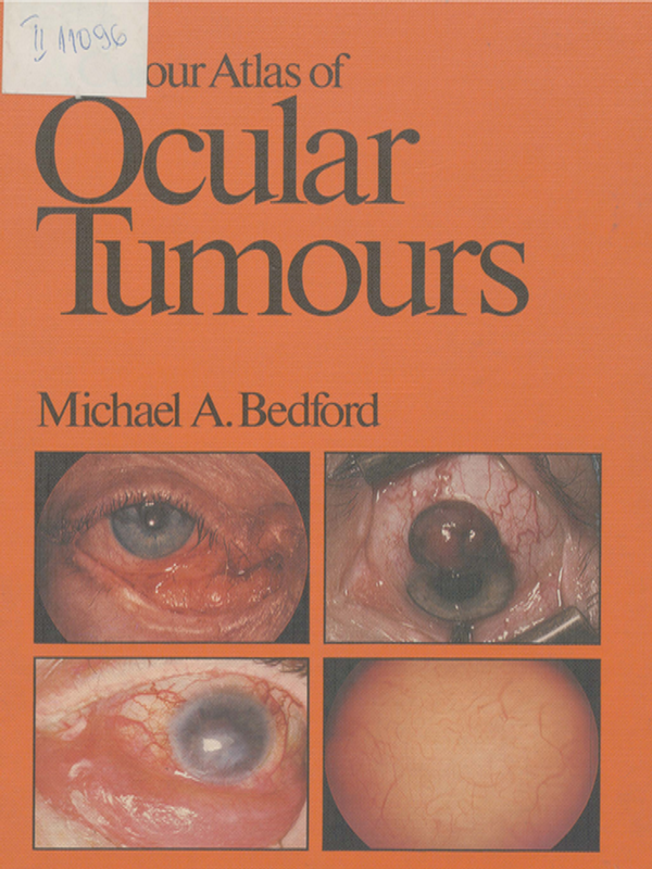 A colour atlas of ocular tumours