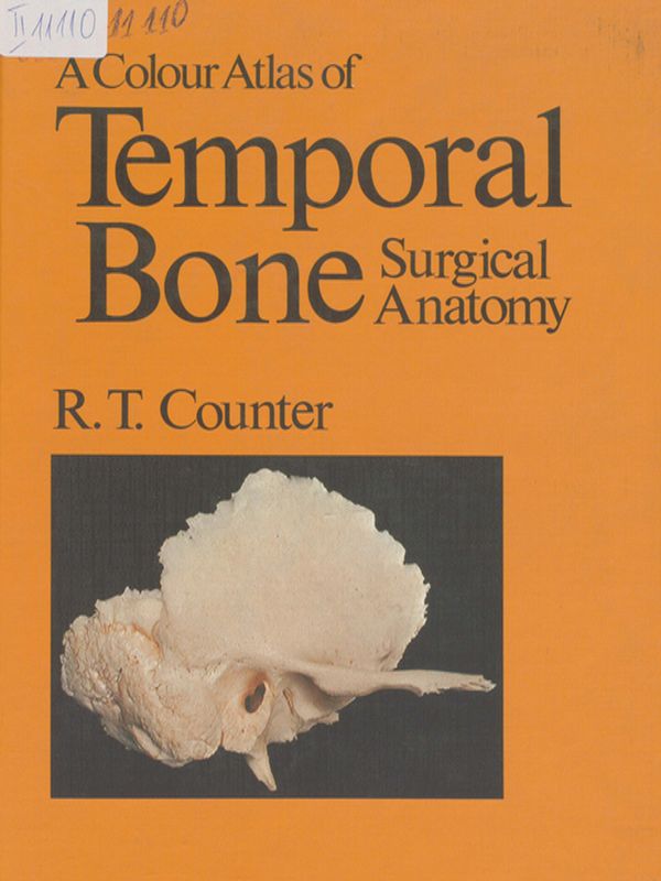 A color atlas of temporal bone