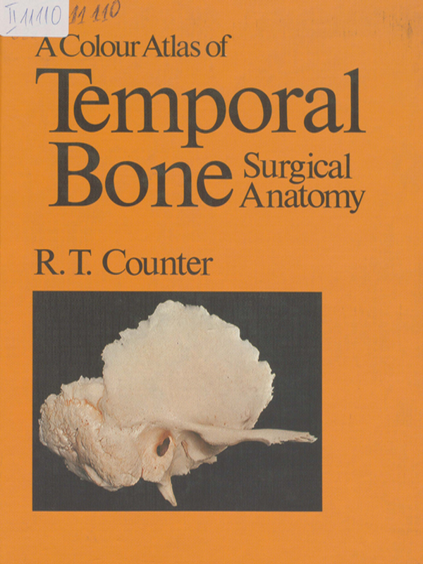A color atlas of temporal bone