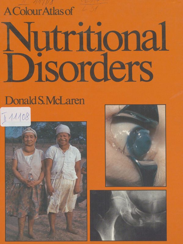 A colour atlas of nutritional disorders