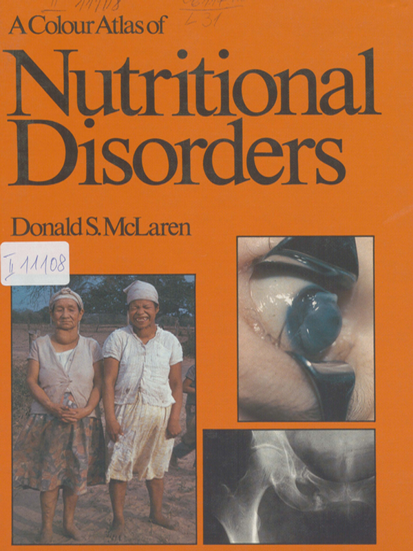 A colour atlas of nutritional disorders