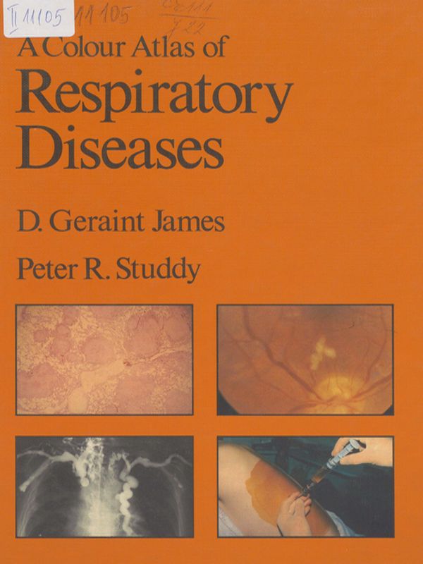 A colour atlas of respiratory diseases