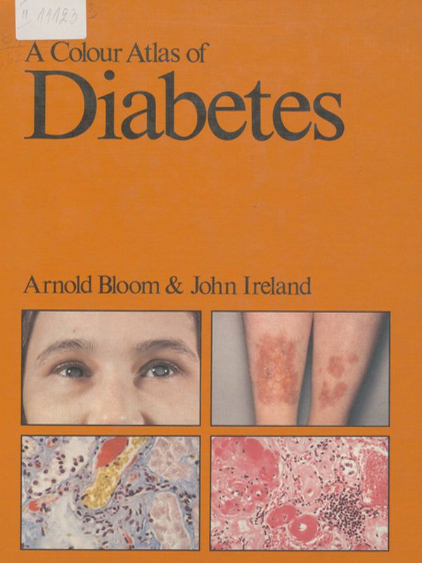 A colour atlas of diabetes