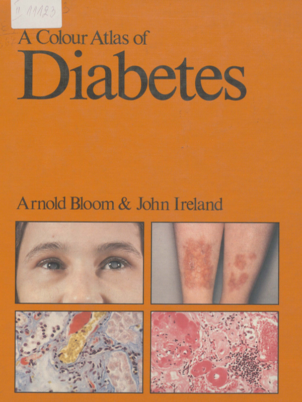 A colour atlas of diabetes