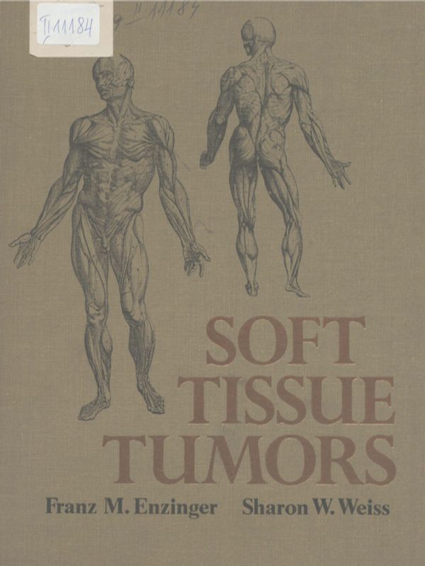 Soft tissue tumors