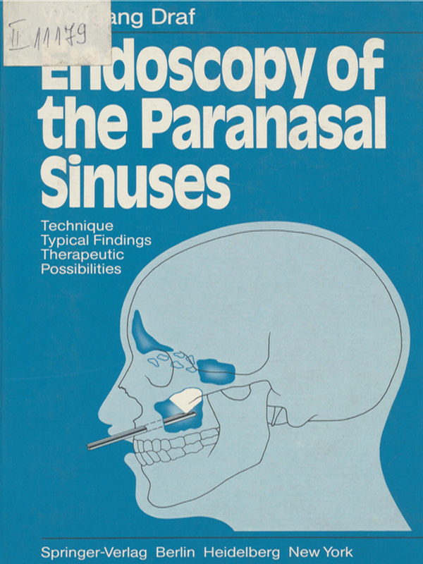 Endoscopy of the paranasal sinuses