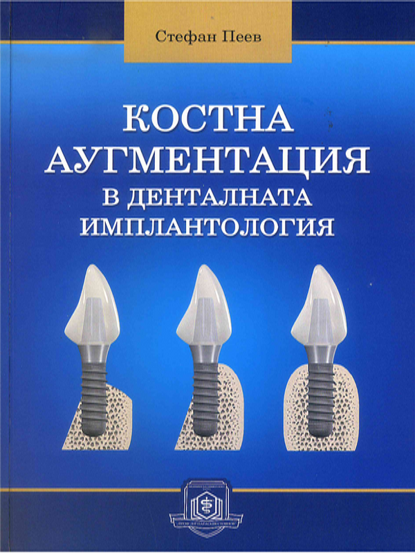 Костна аугментация в денталната имплантология