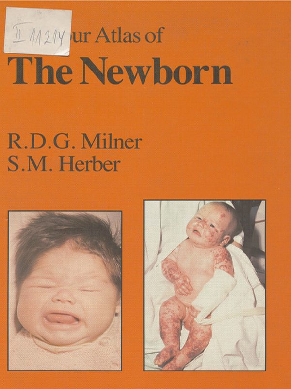 A colour atlas of the newborn