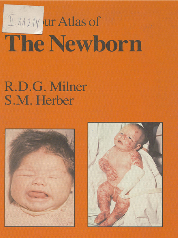 A colour atlas of the newborn