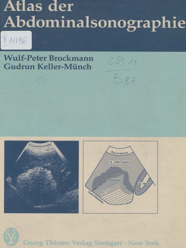 Atlas der Abdominalsonographie