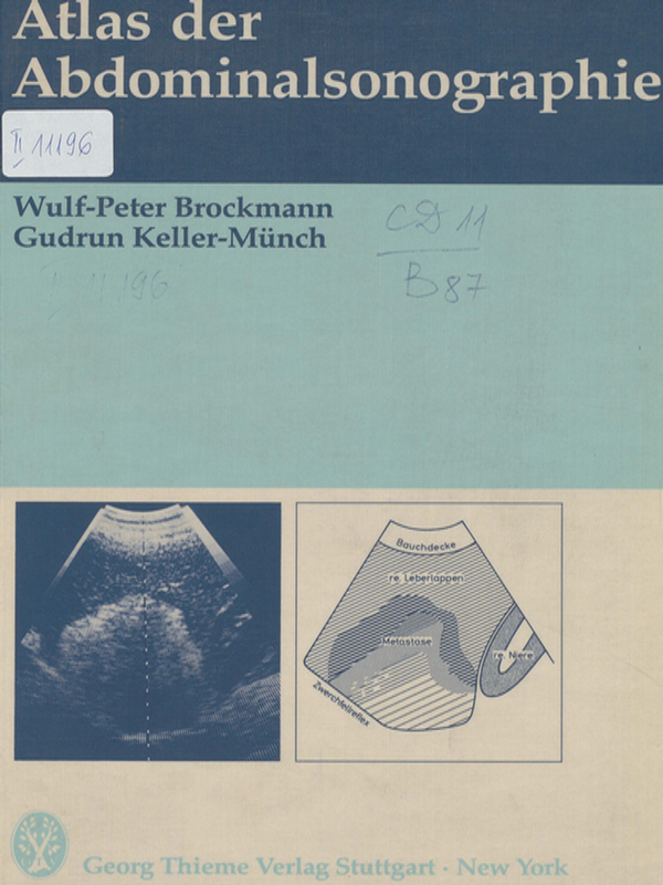 Atlas der Abdominalsonographie
