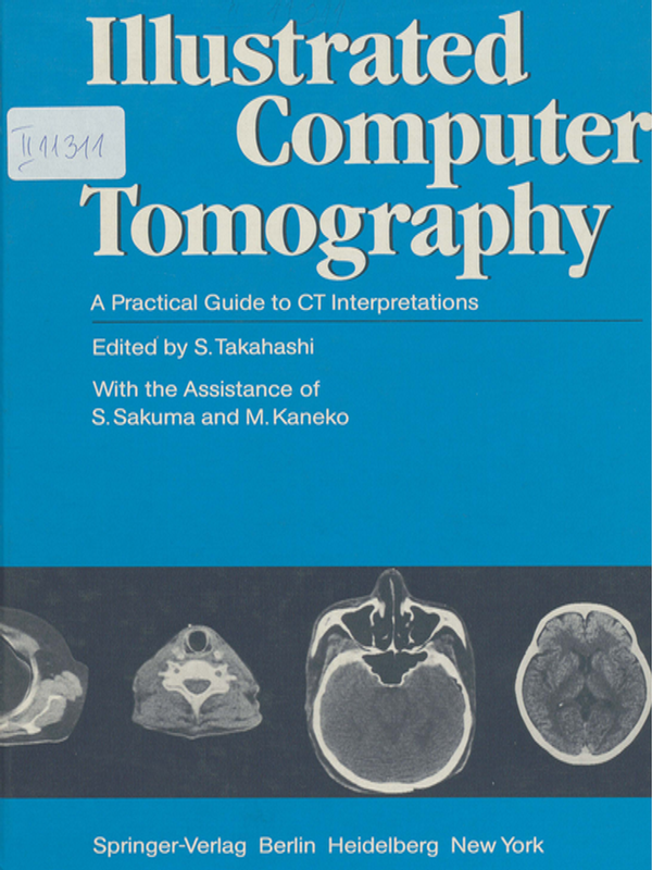 Illustrated computer tomography