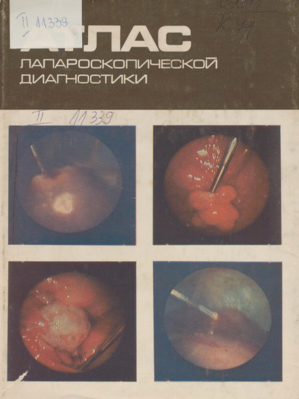 Атлас лапароскопической диагностики