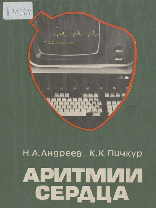 Аритмии сердца