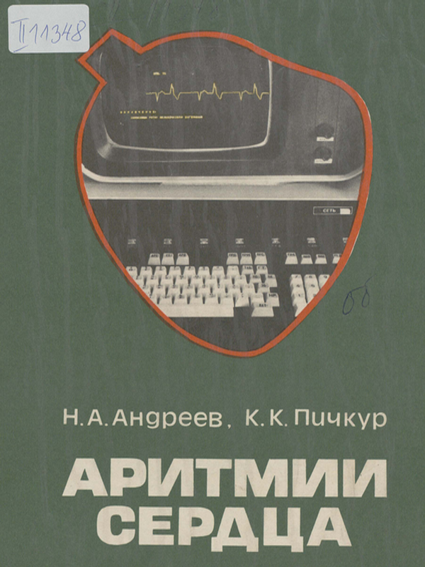 Аритмии сердца