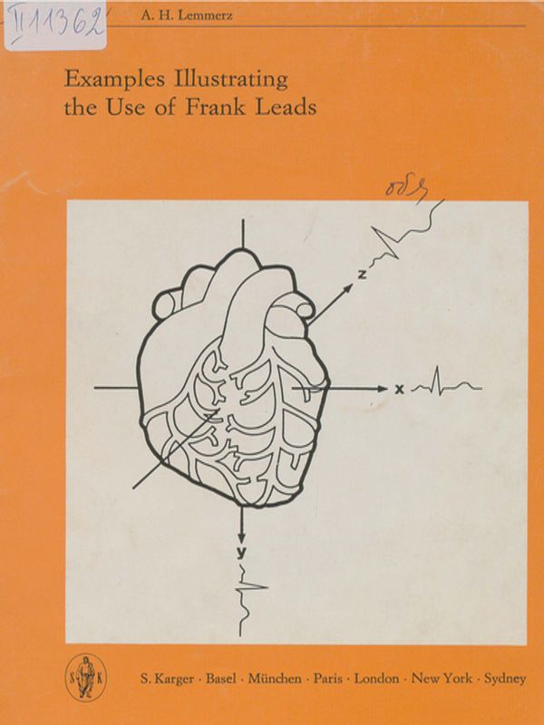 Examples illustrating the use of Frank Leads