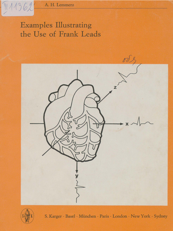 Examples illustrating the use of Frank Leads