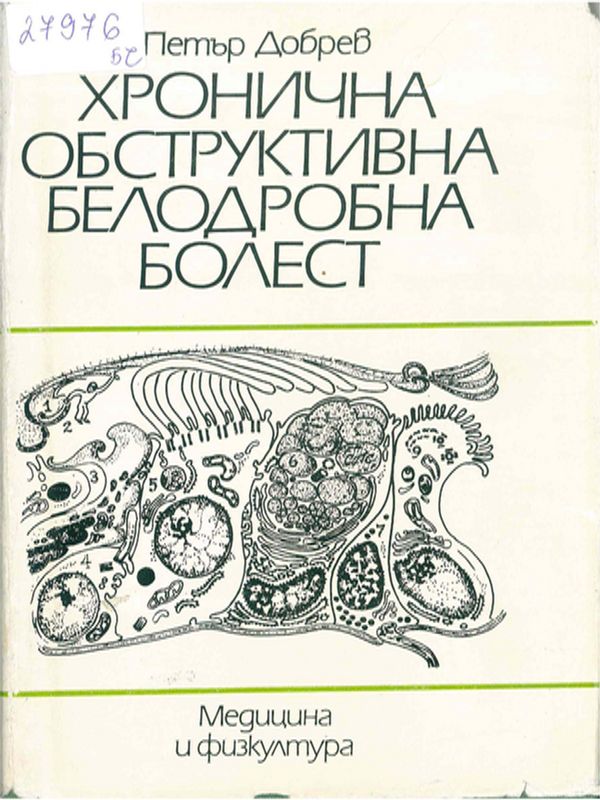 Хронична обструктивна белодробна болест