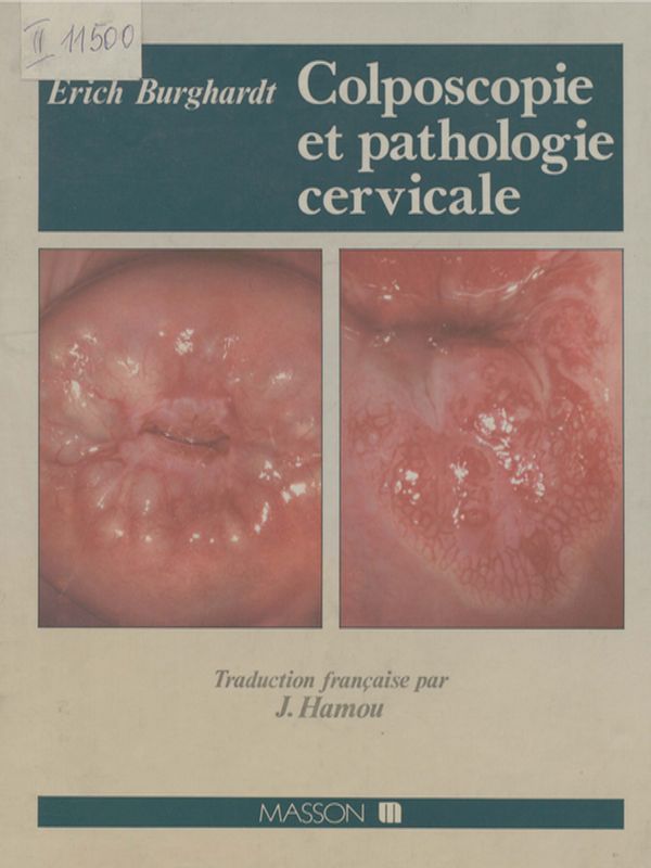 Colposcopie et pathologie cervicale