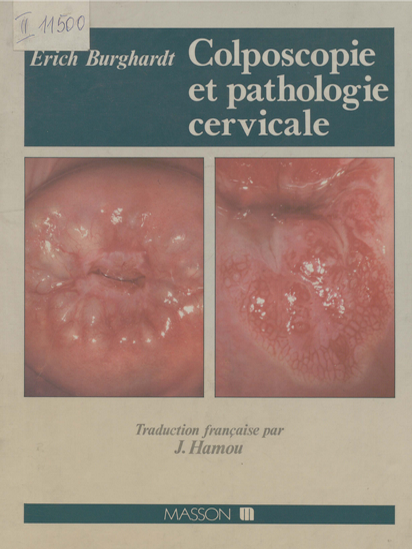 Colposcopie et pathologie cervicale