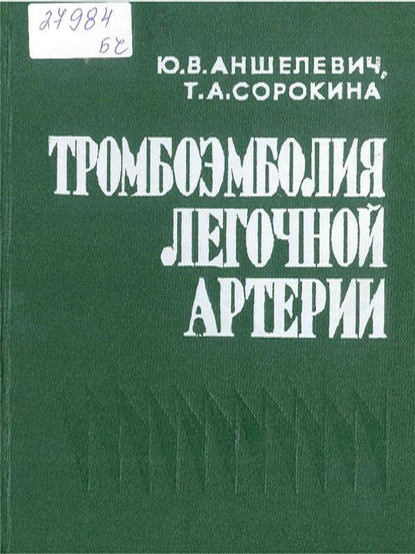 Тромбоэмболия легочной артерии