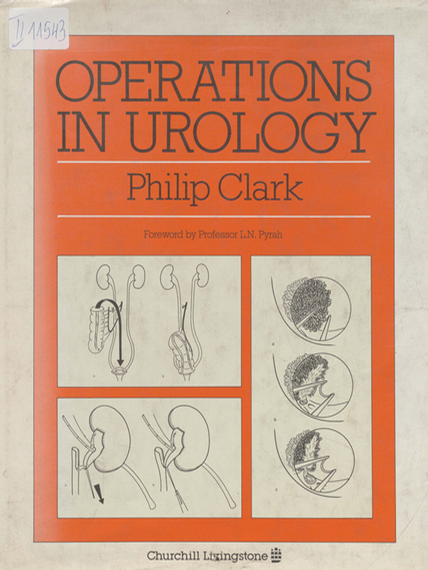 Operations in urology