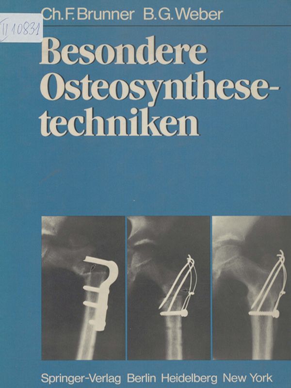 Besondere Osteosynthesetechniken