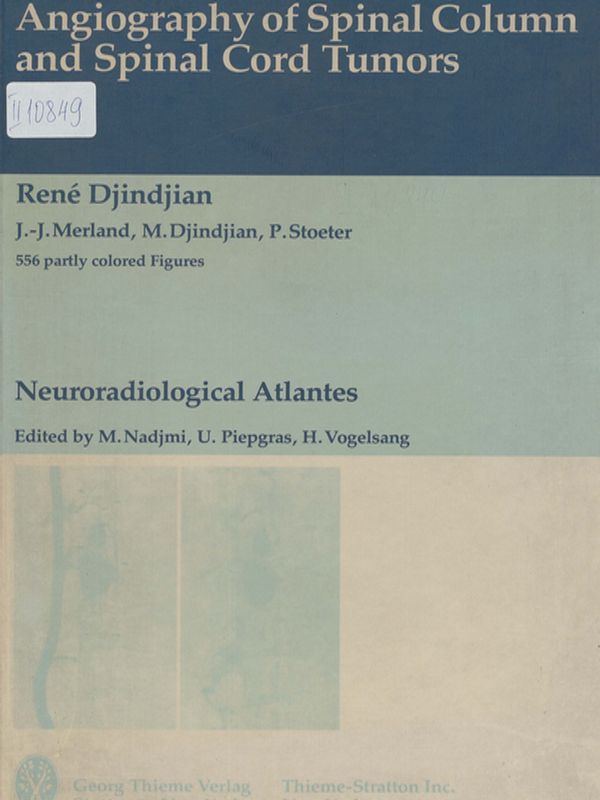 Angiography of spinal column and spinal cord tumors