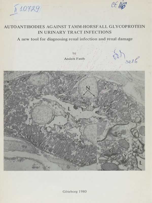 Autoantibodies against Tamm-Horsfall glycoprotein in urinary tract infections