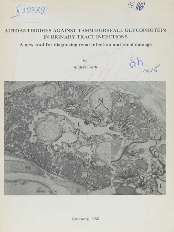 Autoantibodies against Tamm-Horsfall glycoprotein in urinary tract infections