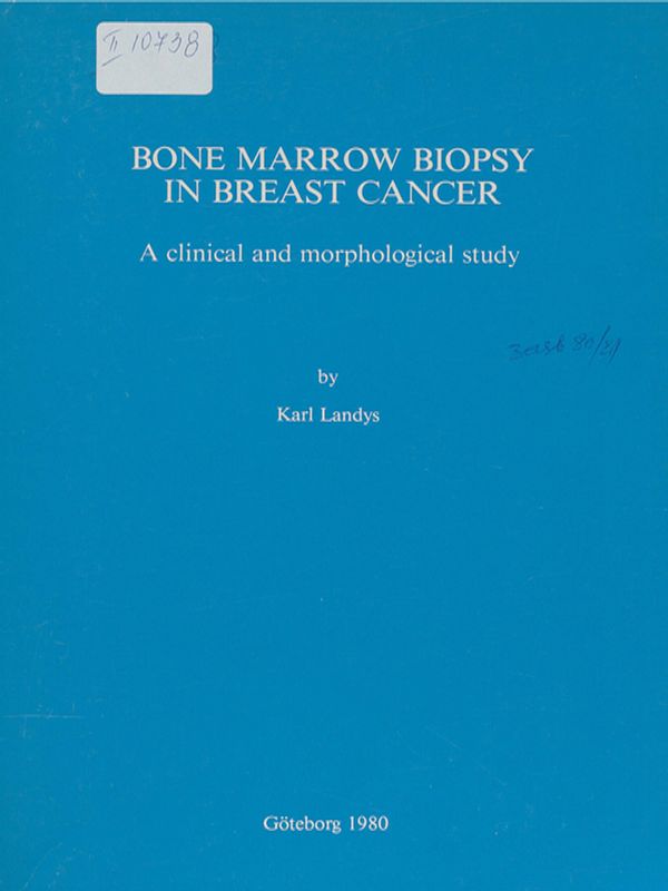 Bone marrow biopsy in breast cancer