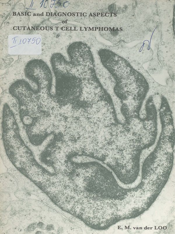 Basic and diagnostic aspects of cutaneous T cell lymphomas