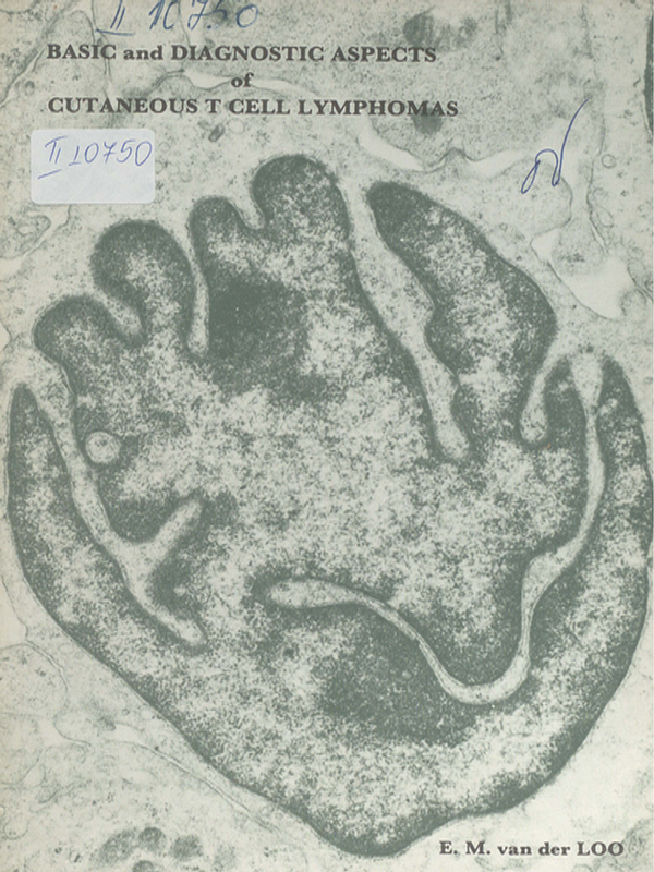 Basic and diagnostic aspects of cutaneous T cell lymphomas