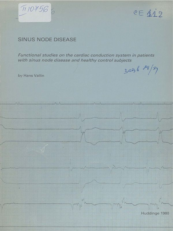 Sinus node disease