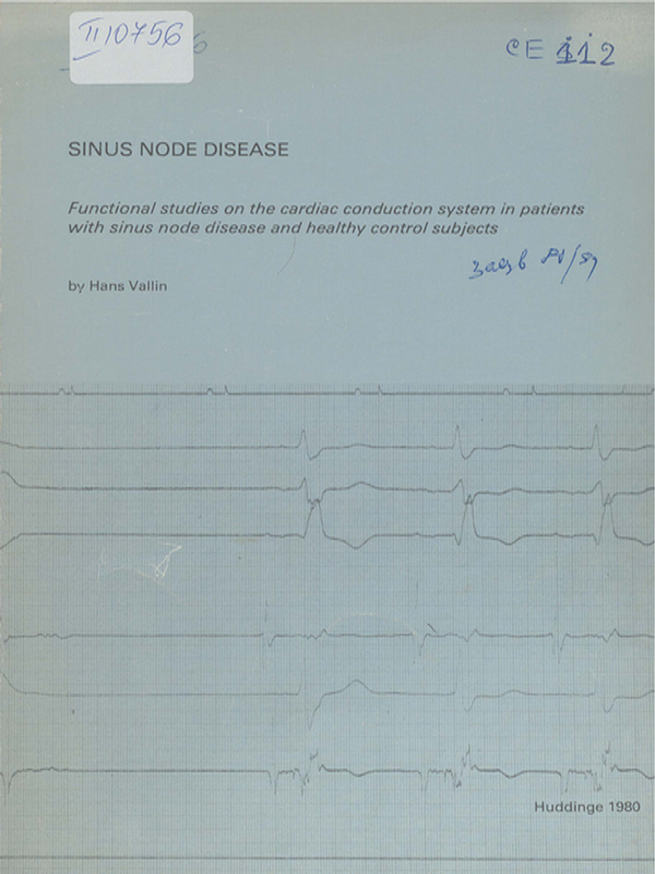 Sinus node disease
