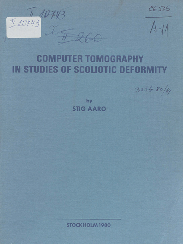 Computer tomography in studies of scoliotic deformity