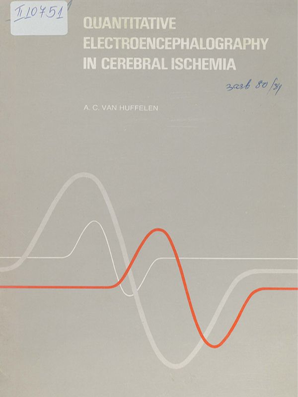 Quantitative electroencephalography in cerebral ischemia