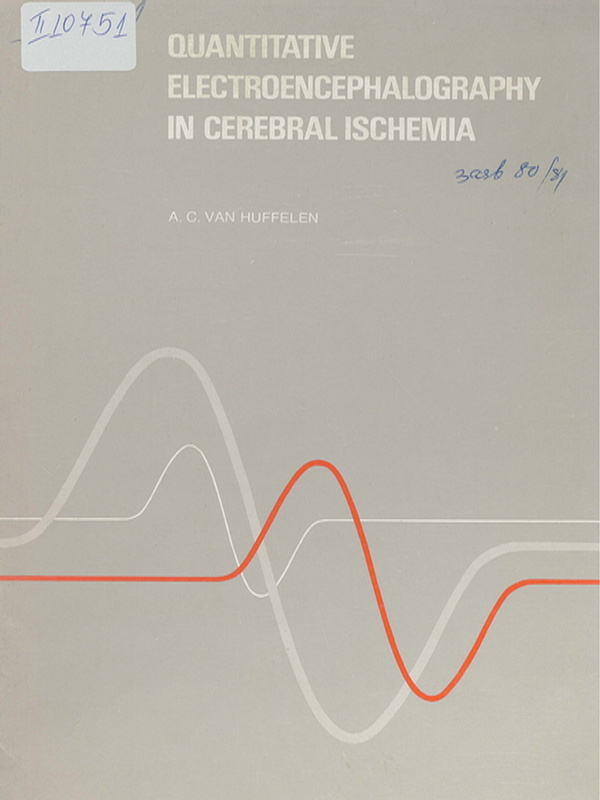 Quantitative electroencephalography in cerebral ischemia