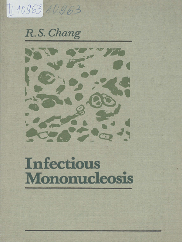 Infectious mononucleosis