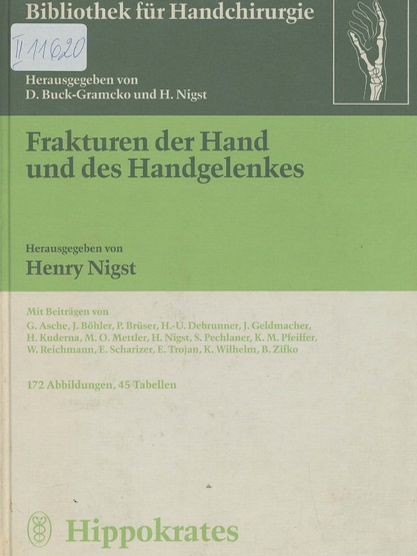 Frakturen der Hand und des Handgelenkes