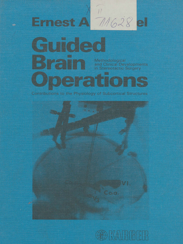 Guided brain operations